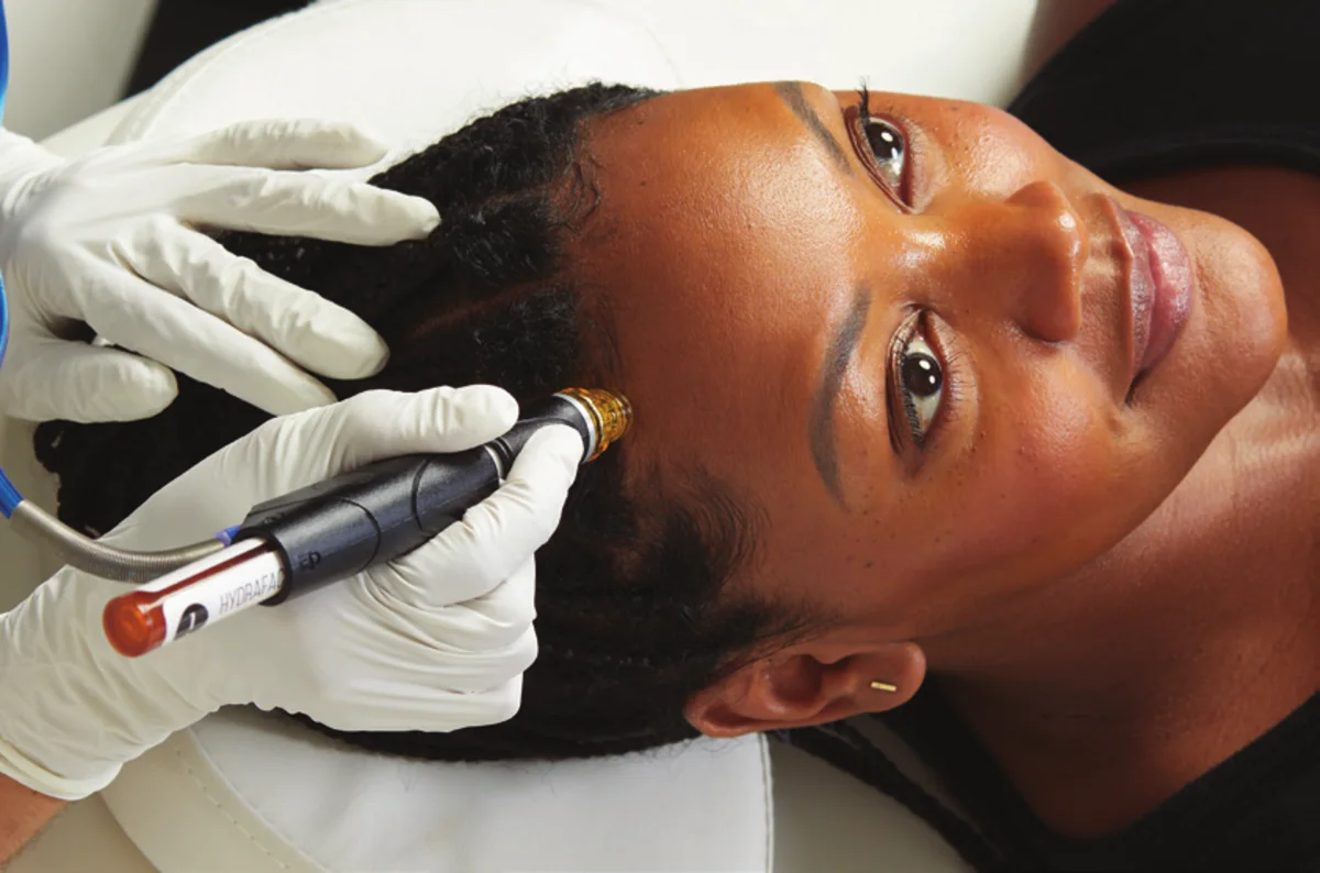 Aplicación de HydraFacial Keravive: la punta HydraFacial recorre el cuero cabelludo de una paciente por secciones